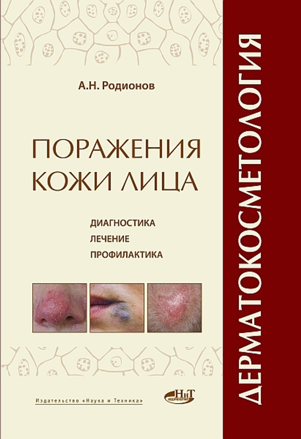 Дерматокосметология: Поражение кожи лица и слизистых. Диагностика, лечение и профилактика
