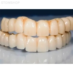 Vector - комбинированный 5-осевой фрезерный станок для влажной и сухой обработки | Dental Machine (Италия)