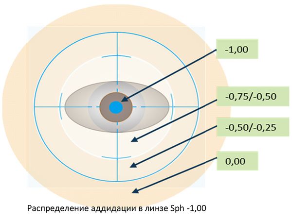 Линзы Focus Plus и Focus Max: идеальное решение для вашего зрения