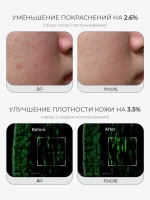 Medicube Укрепляющая сыворотка с ПДРН и пептидами PDRN Pink Peptide Serum 30 мл