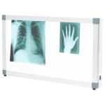 Негатоскоп общего назначения Армед 2-кадровый