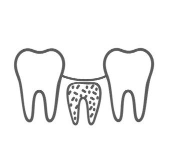РЕШЕНИЯ ДЛЯ КОСТНОЙ ПЛАСТИКИ
