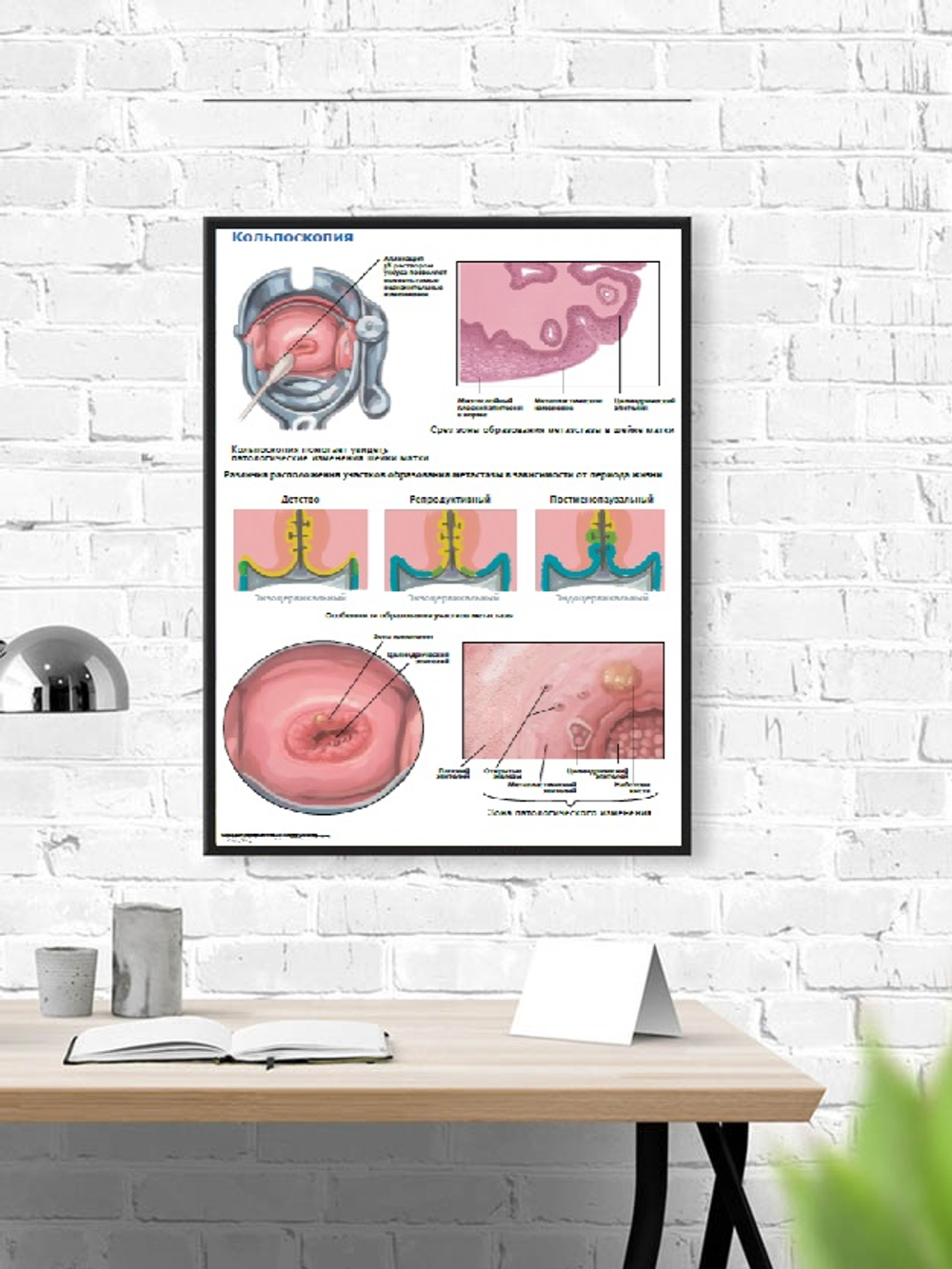 Комплект плакатов для кабинета акушера-гинеколога