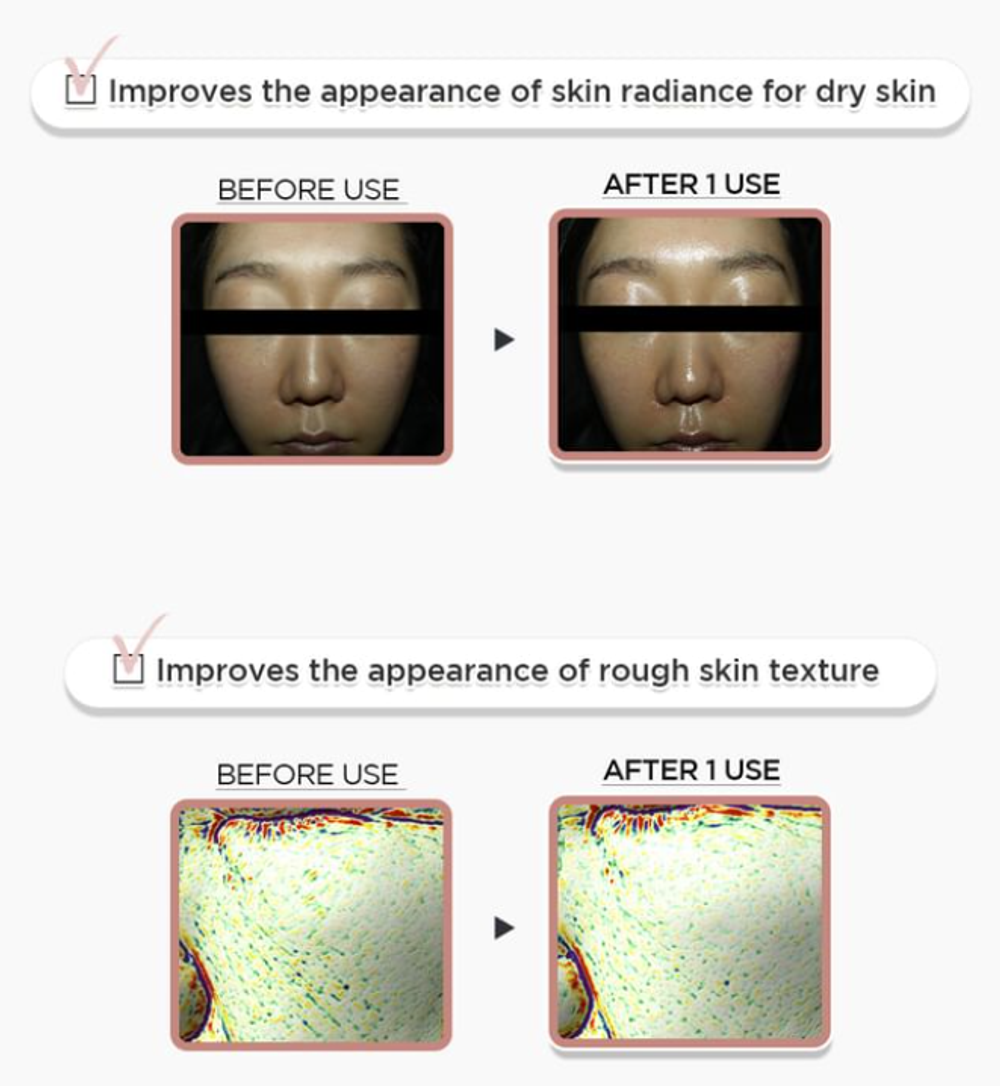 SKIN1004 Крем с ПДРН Madagascar Centella PDRN 1.5 Cream, 30мл
