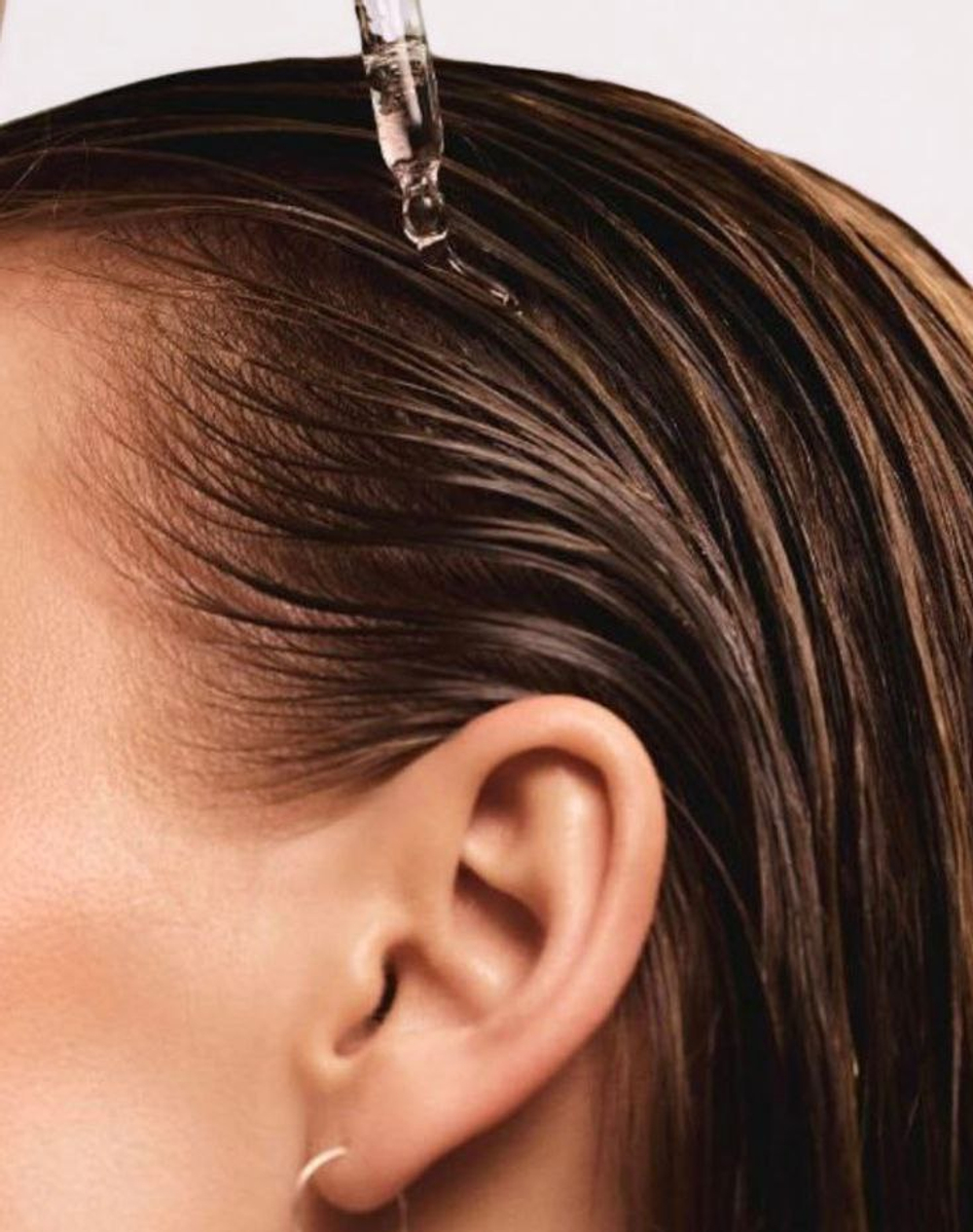 Волос при диффузном выпадении восстановление