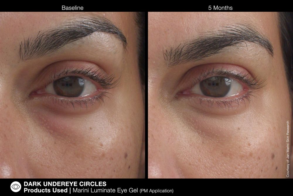 JAN MARINI LUMINATE EYE GEL Концентрированная сыворотка для кожи вокруг глаз с эффектом сияния против темных кругов и морщин