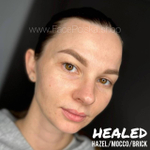 HAZEL