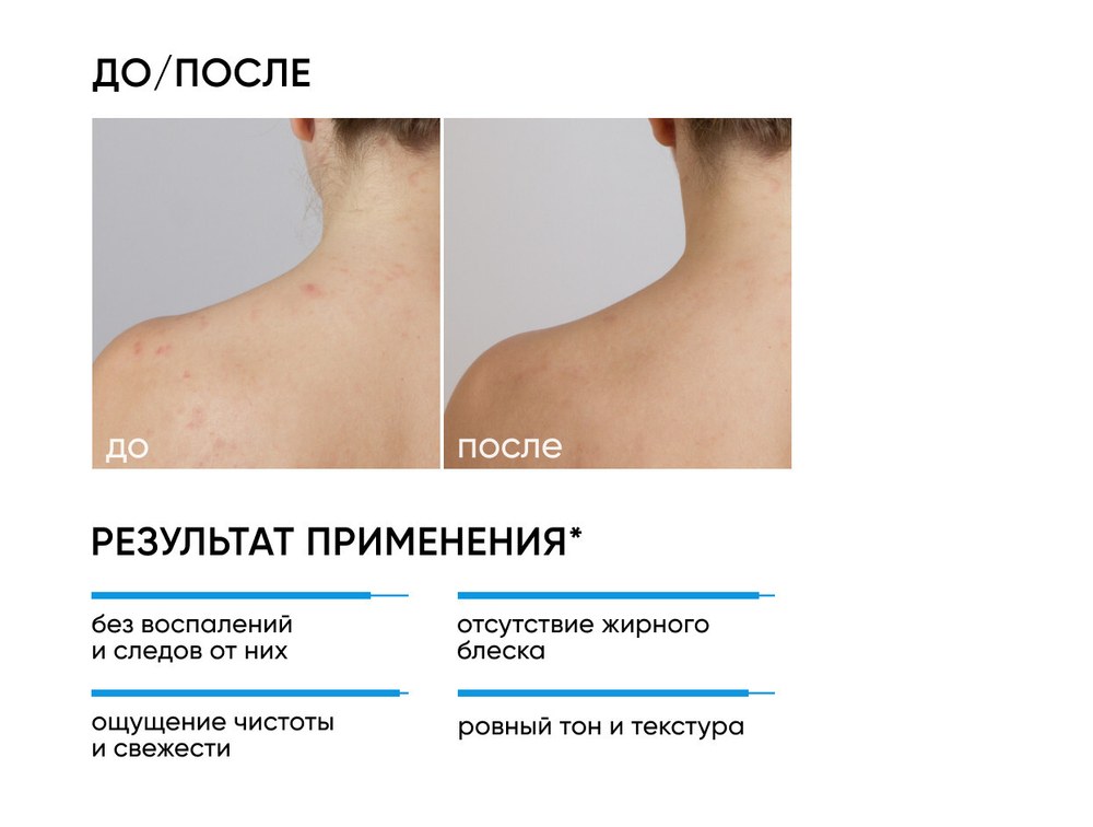 ОЧИЩАЮЩИЙ ГЕЛЬ ДЛЯ ЛИЦА И ТЕЛА BLEMISH CONTROL 2в1 Для комбинированной и жирной проблемной кожи, 250ml