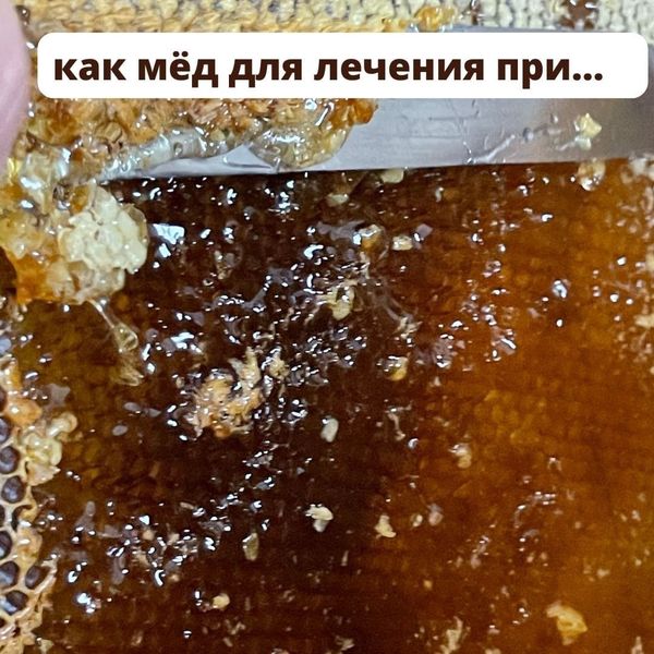 КАКОЙ МЁД ЛУЧШЕ ДЛЯ ЛЕЧЕНИЯ?