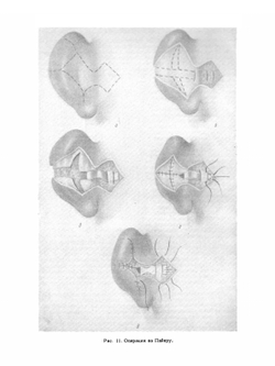 Руководство по оториноларингологии. Болезни уха | А.Г. Лихачев