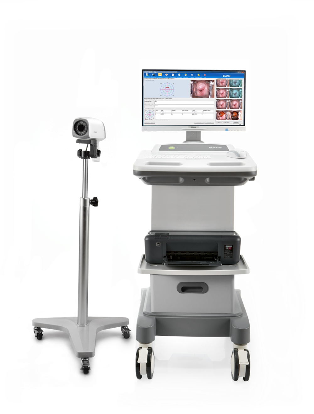 Видеокольпоскоп Edan C6 и Edan C6A