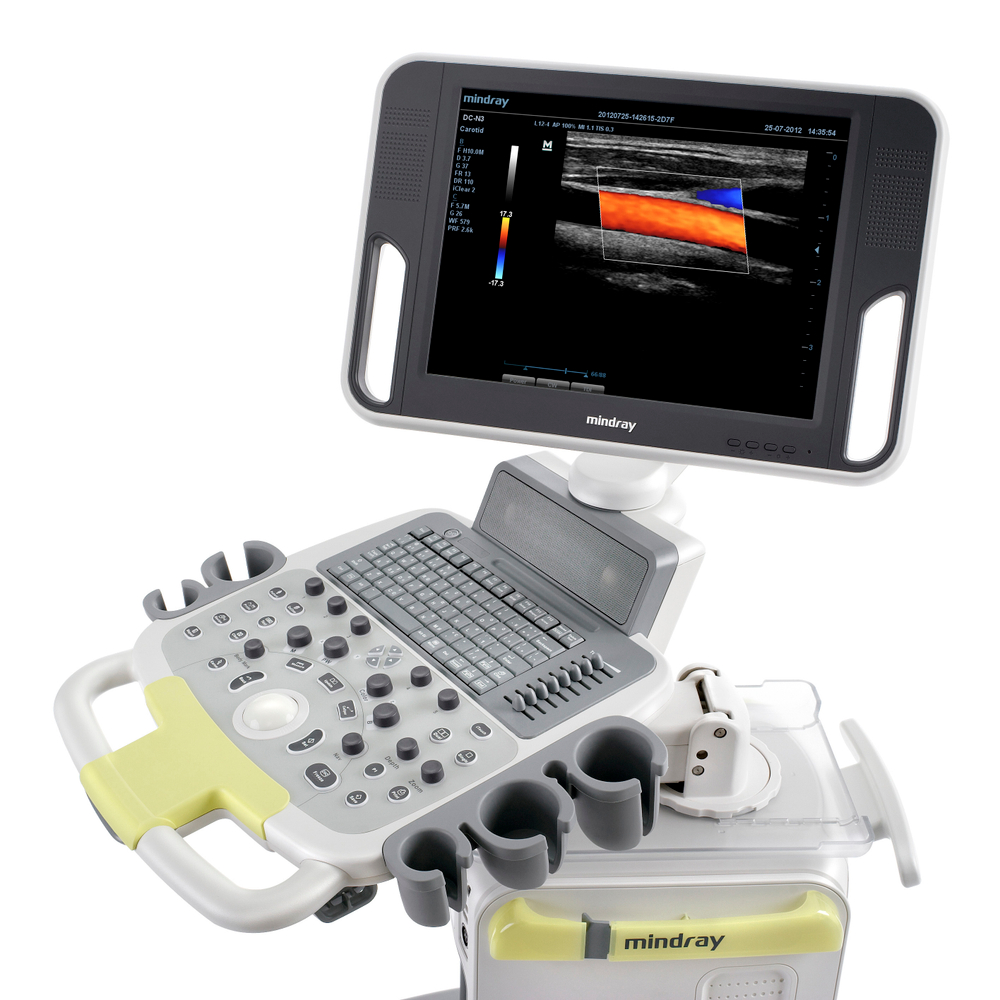 УЗИ аппарат Mindray DC-N3