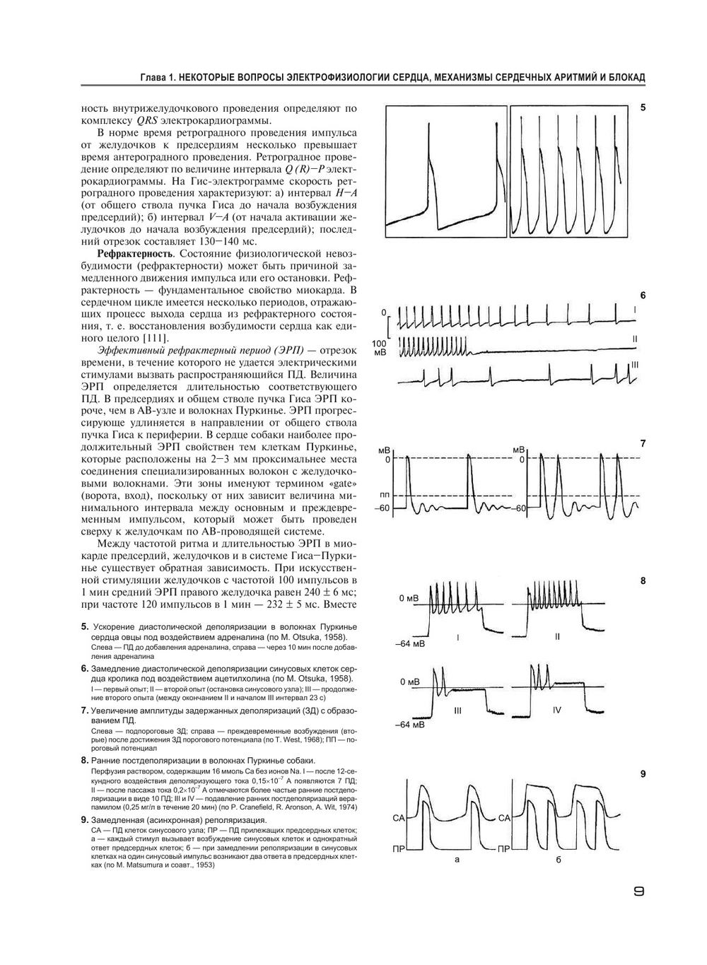 Аритмии и блокады сердца. Атлас электрокардиограмм | М.С. Кушаковский