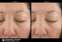 JAN MARINI HYLA3D FACE SERUM Сыворотка-акселератор с 3D гиалуроновым комплексом