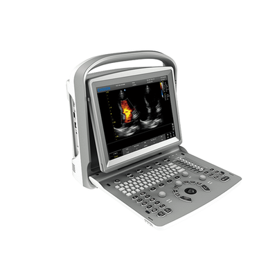 УЗИ аппарат CHISON ECO 6