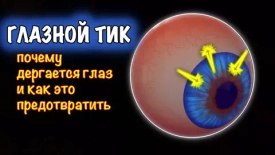 Почему глаза дёргаются? Разбираемся в причинах
