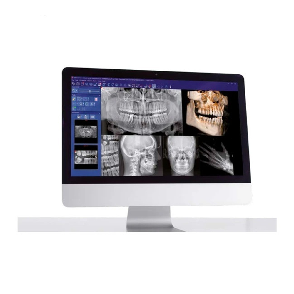 Стоматологический томограф с цефалостатом Castellini X-Radius Trio Plus