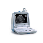УЗИ аппарат Mindray DP 3300