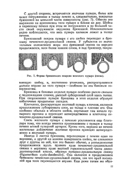 Хирургия желчного пузыря и желчных протоков | И.М. Тальман