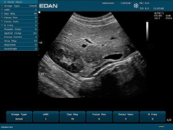 Аппарат УЗИ Edan U50 (для педиатрии и кардиологии, стандартный)