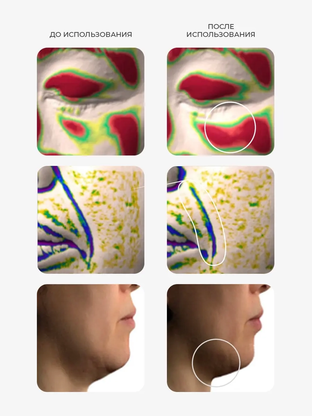 Arocell Мощная пузырьковая сыворотка с низкомолекулярным коллагеном Super Collagen Booster Serum 30 мл