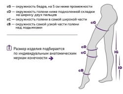 Чулки компрессионные Тривес ТК.231, 1 класс, закрытый мысок, бежевые
