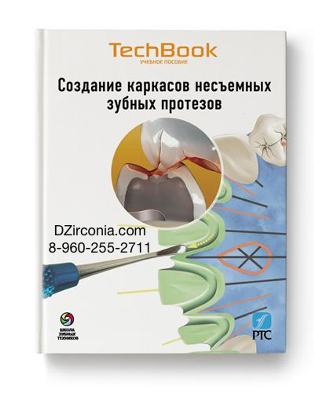 СОЗДАНИЕ КАРКАСОВ НЕСЪЕМНЫХ ЗУБНЫХ ПРОТЕЗОВ