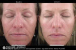 JAN MARINI AGE INTERVENTION RETINOL PLUS MD 1% Крем-акселератор с ретинолом 1% для борьбы с видимыми возрастными изменениями