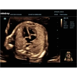 Аппарат УЗИ (сканер) Mindray DC-70