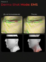 Medicube Микротоковый аппарат для лица 6-в-1 AGE-R Booster Pro Pink