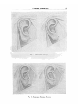 Руководство по оториноларингологии. Болезни уха | А.Г. Лихачев