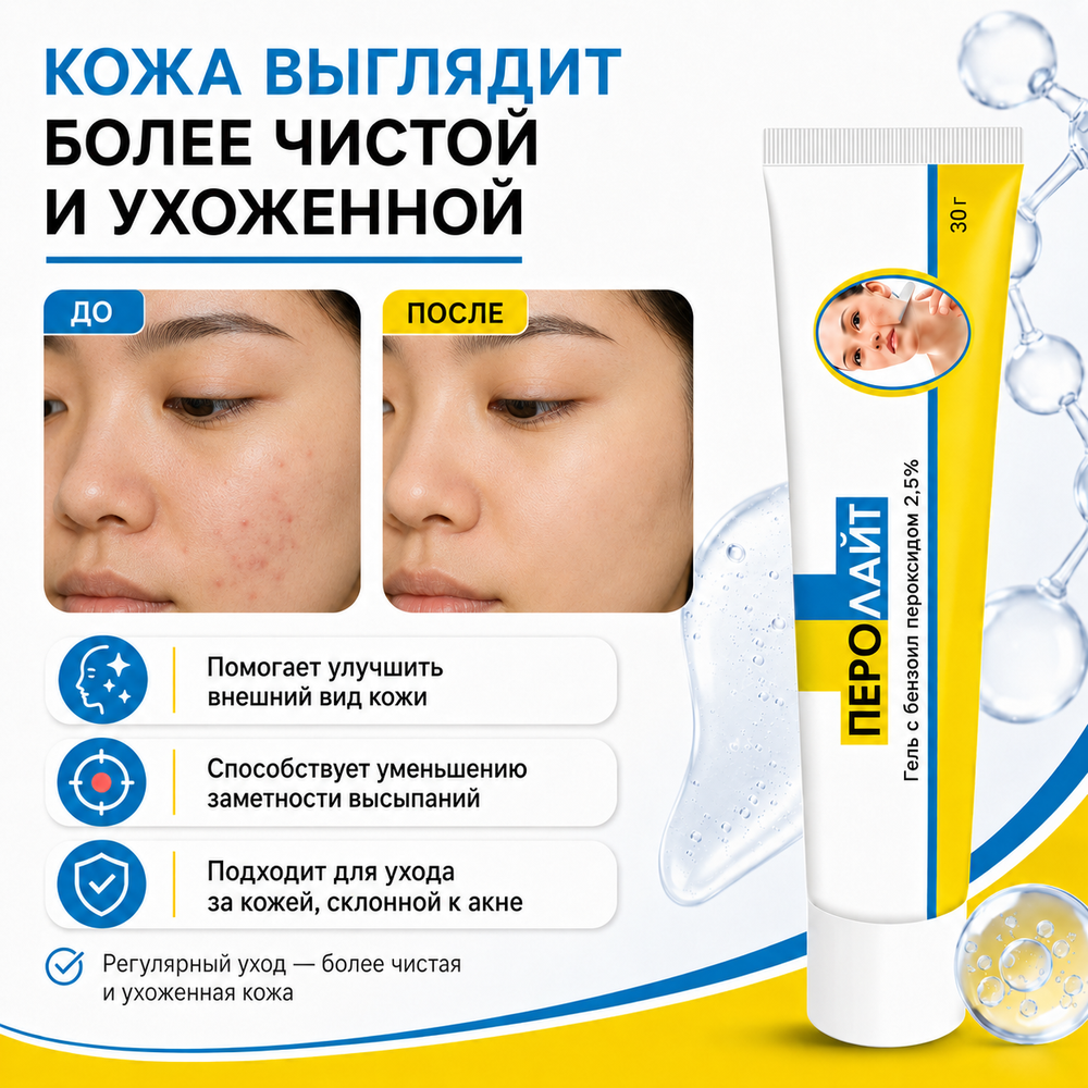 ПЕРОЛАЙТ 2.5% гелі