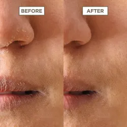 Успокаивающий гель для умывания с азуленом и церамидами SUR.MEDIC+ Azulene Soothing pH Cleanser 150 мл