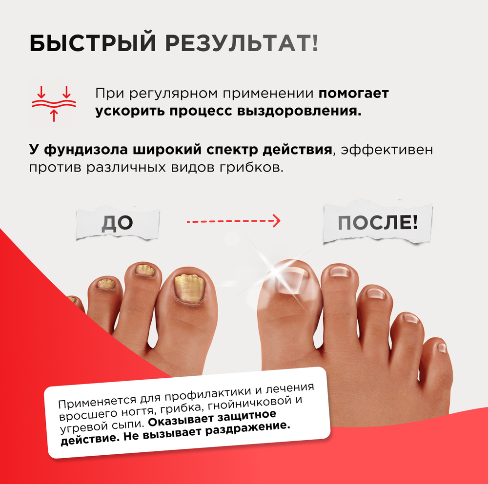 Крем для ногтей и кожи, ФУНДИЗОЛ, 30мл, ИНФАРМА