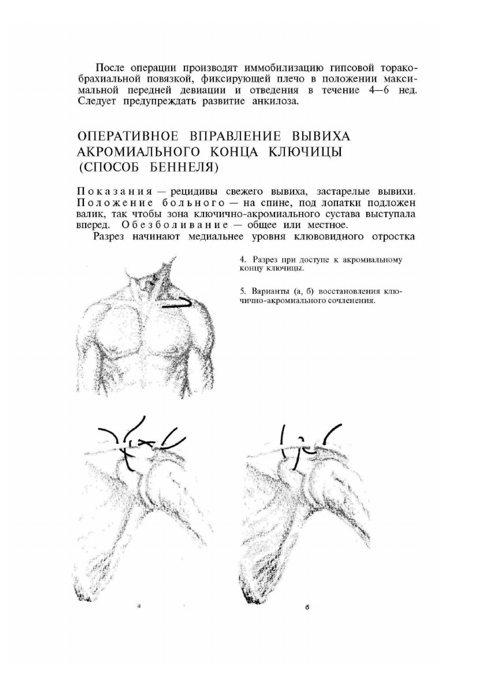 Атлас операций при травмах опорно-двигательного аппарата | Т.А. Ревенко