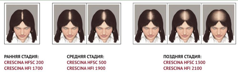 Crescina Transdermic HFSC 100% RE-GROWTH + ANTI-HAIR LOSS КОМПЛЕКС лосьон для возобновления роста волос + лосьон против выпадения волос для женщин. Дозировка 1300 / 10+10 ампул