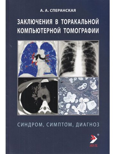 Заключение в торакальной компьютерной томографии. Симптом, синдром, диагноз
