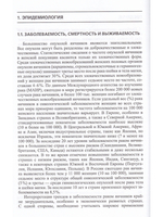 Опухоли яичника (клиника, диагностика и лечение)