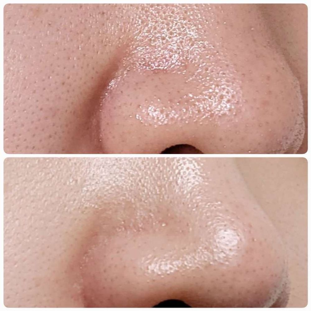 ANUA Гидрофильное масло для глубокого очищения пор Heartleaf Pore Control Cleansing Oil, 200ml.