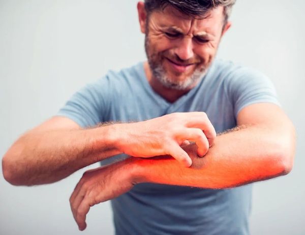 Не чеши там, где чешется… Кожный зуд при диабете.