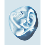 Centellian24 Гель для лица увлажняющий - Madeca gel serum hyalron dew, 30 мл