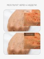 Arocell Солнцезащитная сыворотка с транексамовой кислотой, мелатонином и глутатионом SPF50 Mela TXA Sun Serum 40 мл