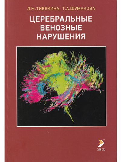Церебральные венозные нарушения