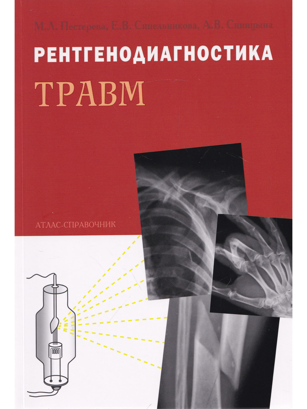 Рентгенодиагностика травм
