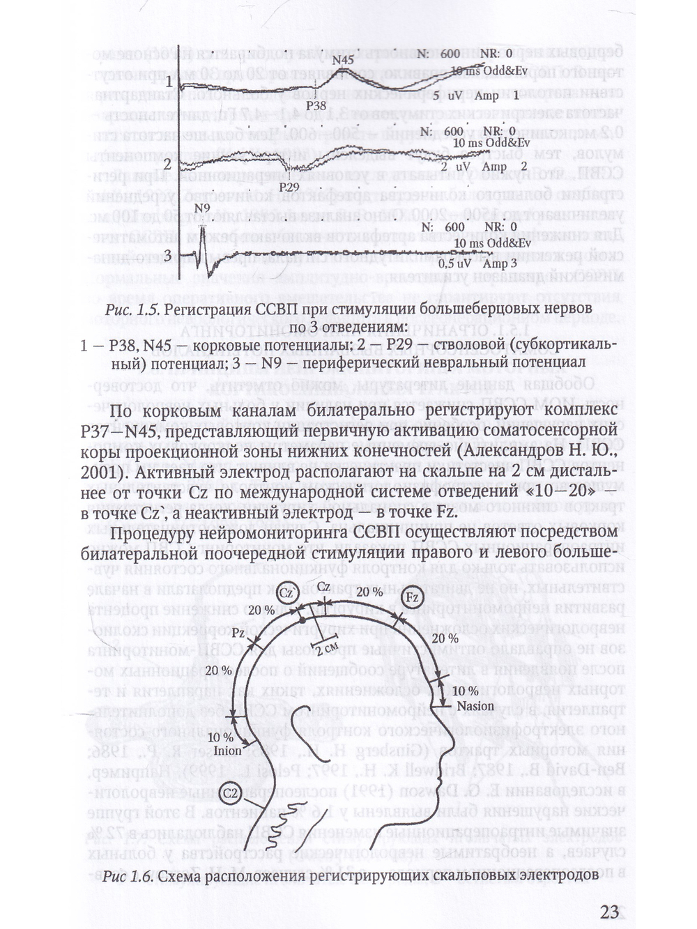 Электрофизиологический мониторинг центральной нервной системы