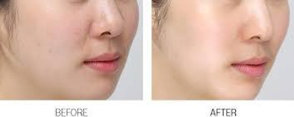 Маска освежающая с витаминным комплексом Medi-Peel Vitamin Bomb Refreshing Mask, 25 мл