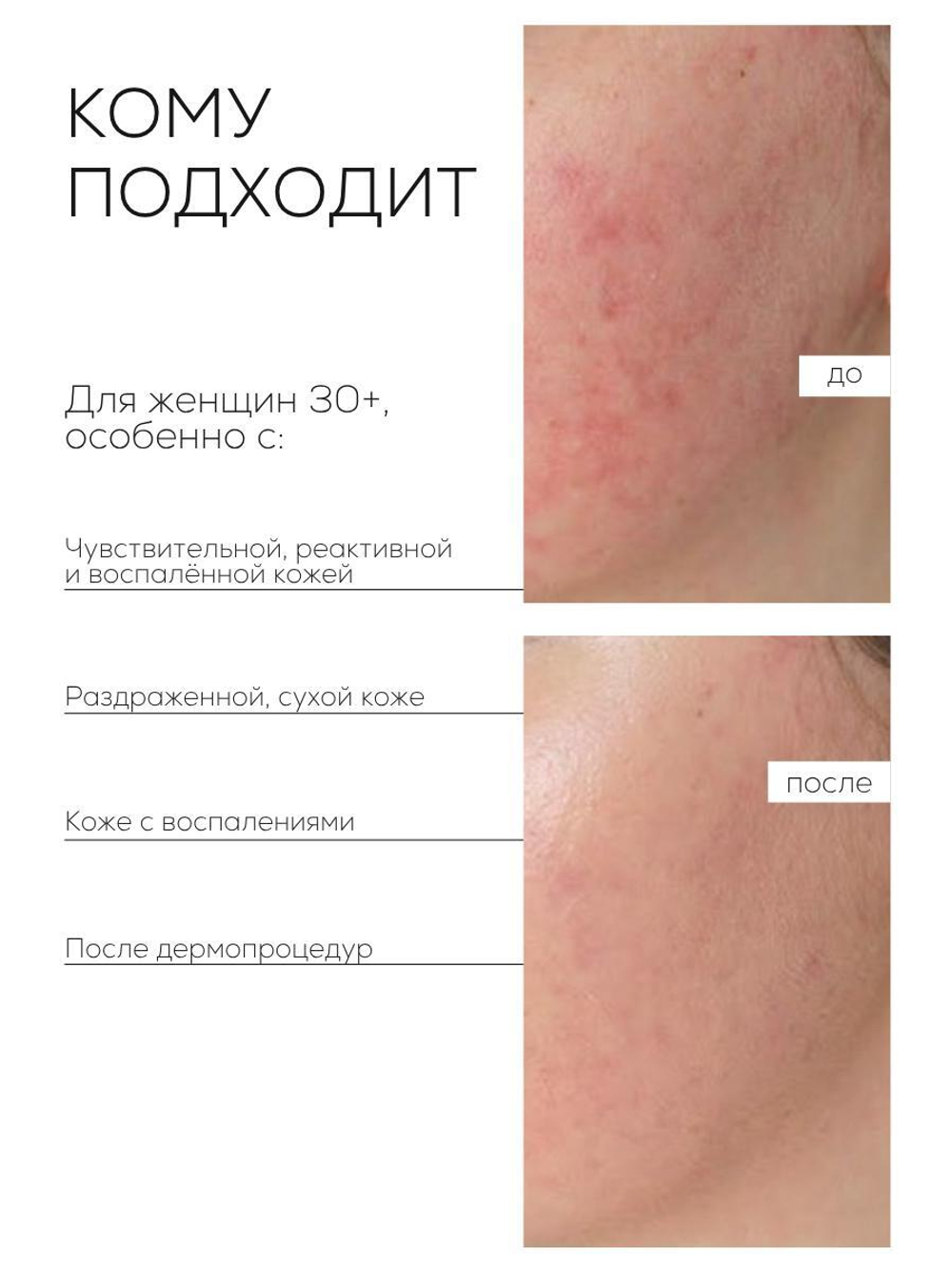 СЫВОРОТКА ДЛЯ ЧУВСТВИТЕЛЬНОЙ И РЕАКТИВНОЙ КОЖИ LAURA ZACKARYA — 2% ЭКТОИН И 2% СКВАЛАН