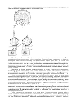 Неотложная рентгено-диагностика. Руководство | А.Н. Кишковский