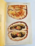"Новый способ лечения. Лечение целебными силами природы."  М. Платен. 1906 г.