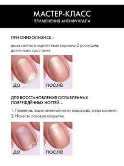 Emi Антифунгал - стимулятор роста, профилактика грибковых заболеваний, 9 мл.